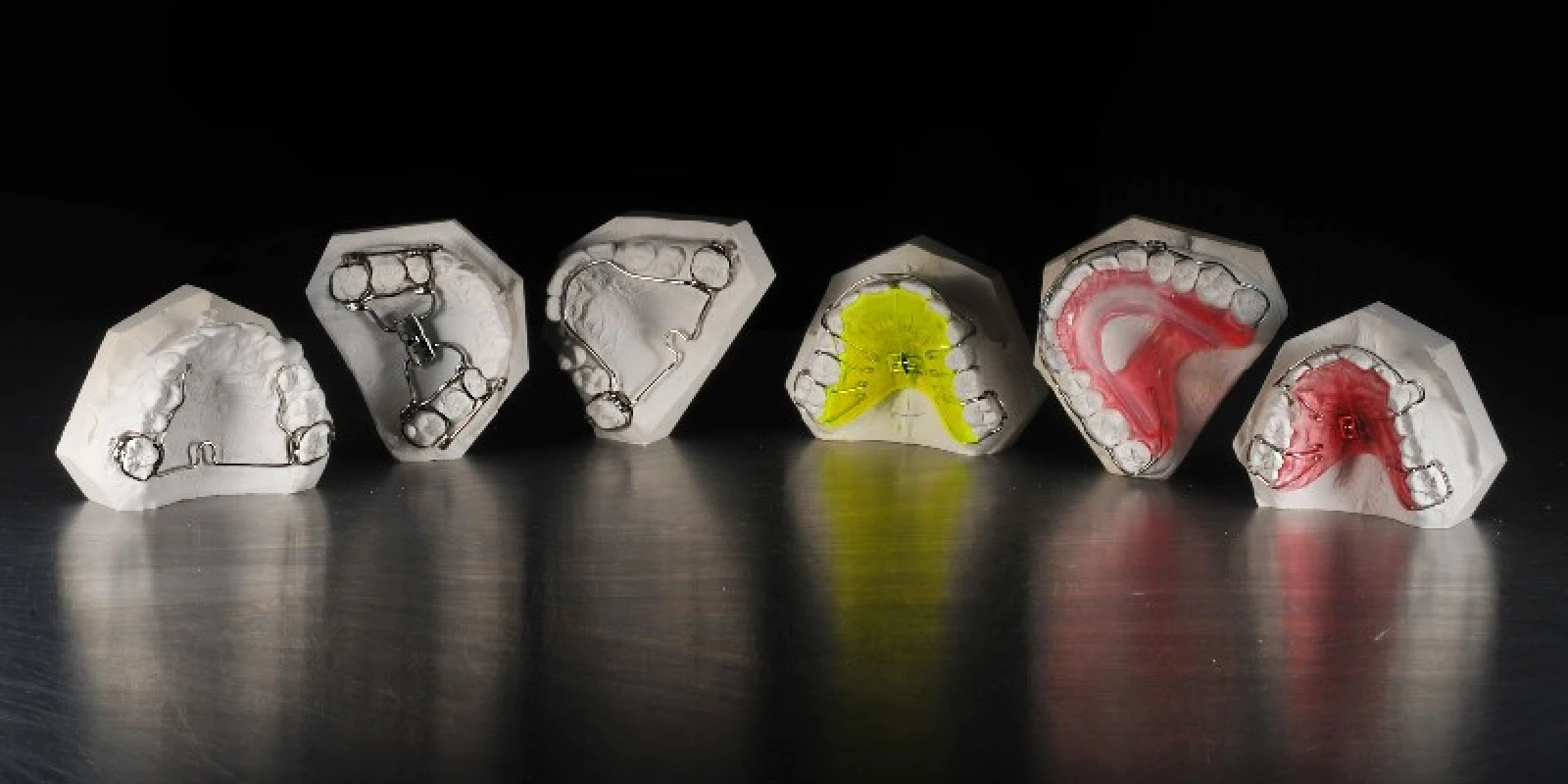 orthese-dentaire-paris laboratoire azm