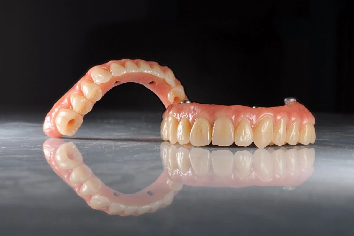 prothese-adjointe-paris (7)