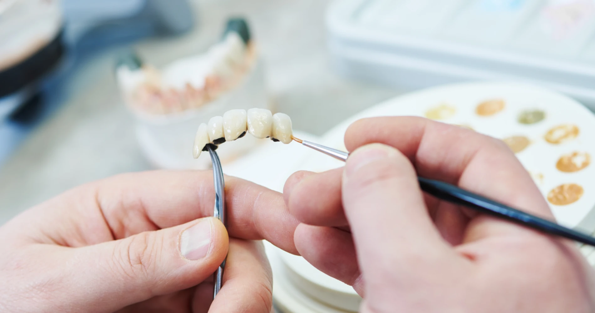 paris-prothese-laboratoire-dentaire-azm